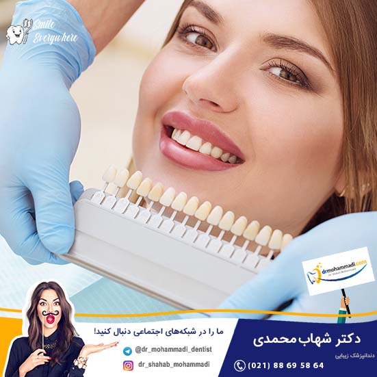 دوام لمینت های سرامیکی چقدر است؟ - کلینیک دندانپزشکی دکتر شهاب محمدی